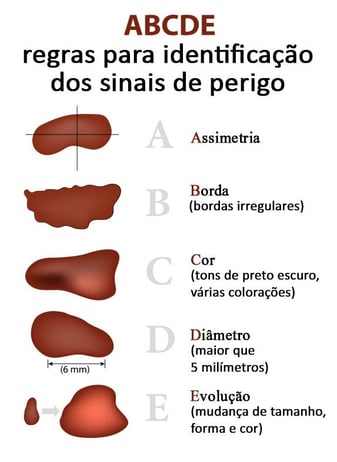 Identificação de manchas câncer de pele ABCDE - Assimetria | Borda | Cor | Diâmetro | Evolução