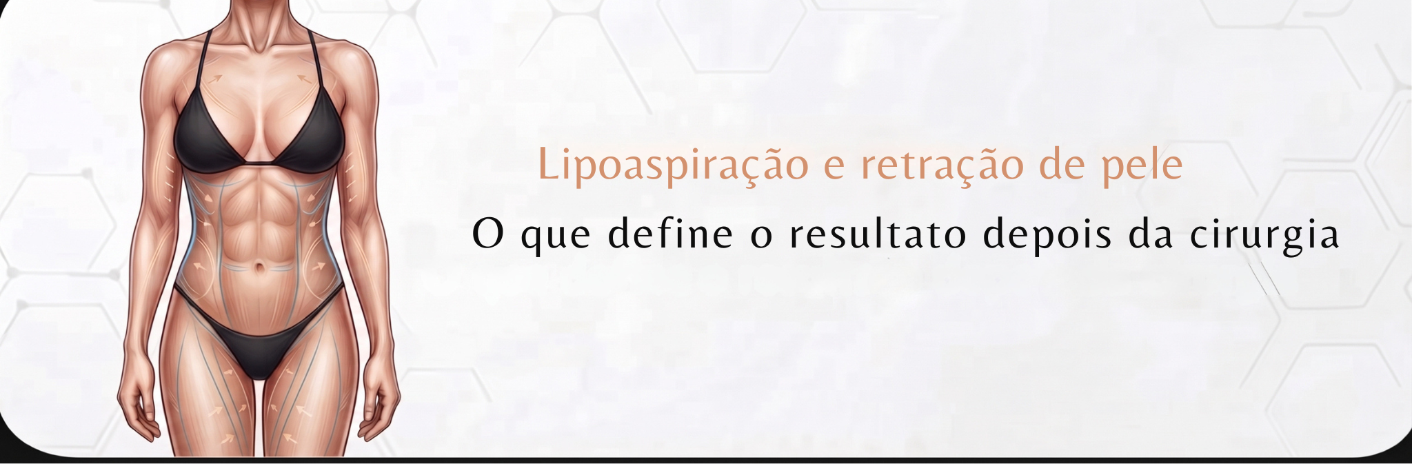 lipoaspiração e retração da pele skintec - Ignite blog