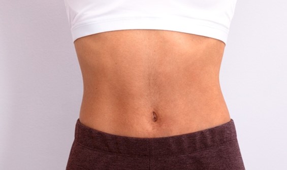 CMSlim_Abdomên_Feminino_Depois_2